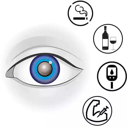 Causes of Cataract Reason for Cataract