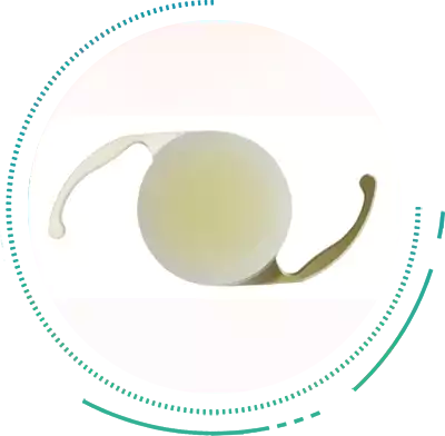 OZIL Technology Cataract Treatment OZIL Technology for Cataract Operation