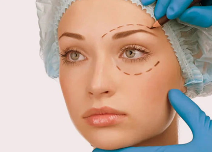 Oculoplasty Treatment in Bangalore Oculoplasty Treatment